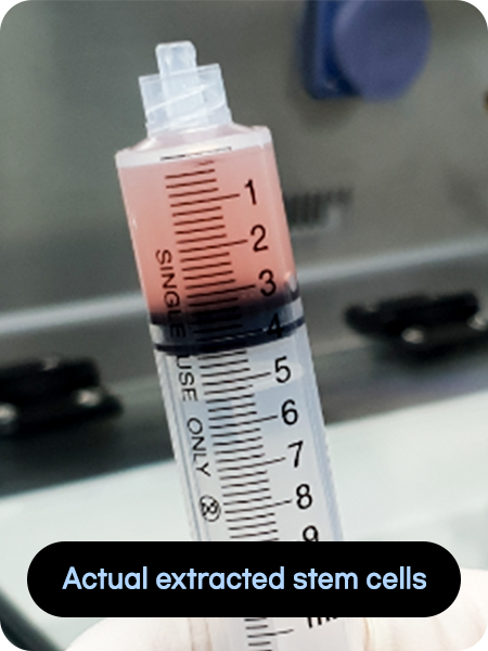 Actual extracted stem cells