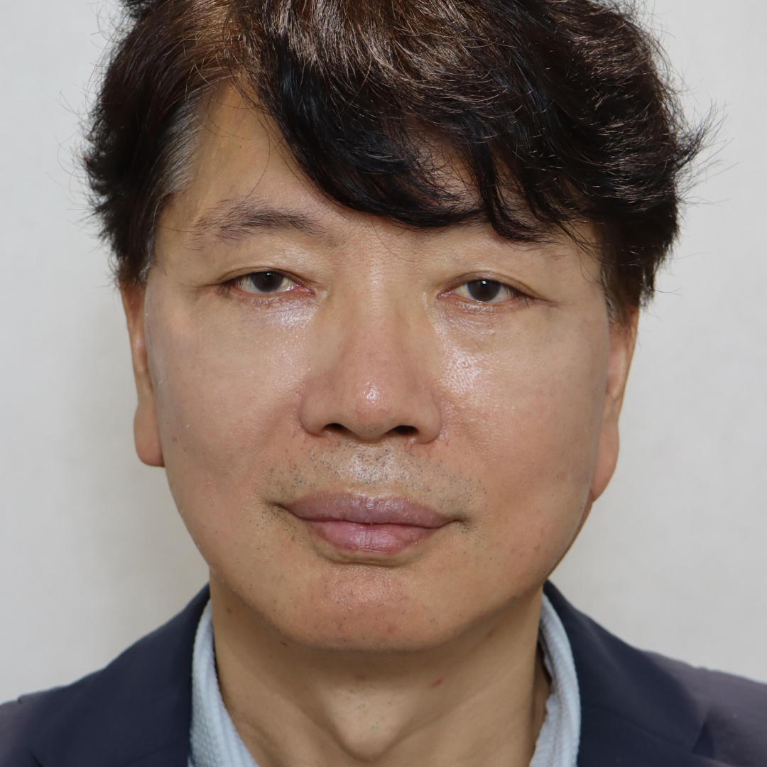 안면거상술 after정면 이미지