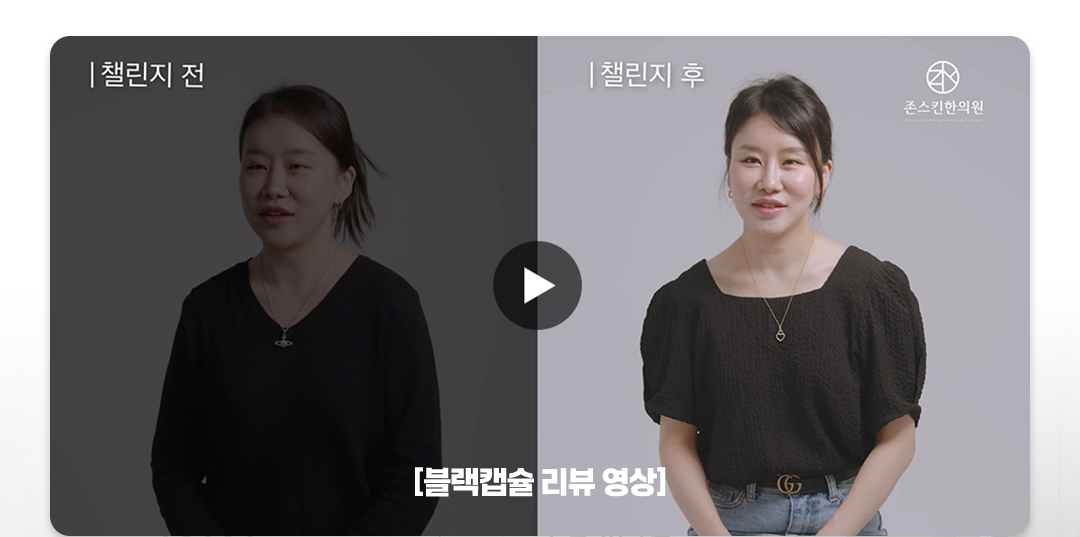 존스키니블랙  블랙캡슐 리뷰영상