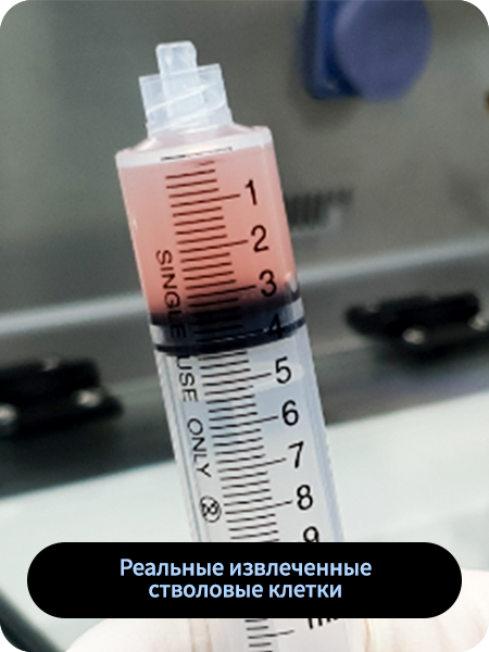 Реальные извлеченные стволовые клетки