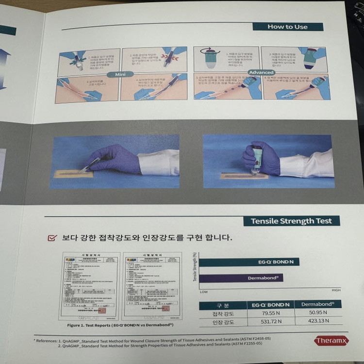 에치콘 더마본드 국산 oem AHVM12 의료용 표피접착제 피부접착제 이지큐본드 미니 : 메딕스메디칼 | 성형외과·피부과 의료 ...