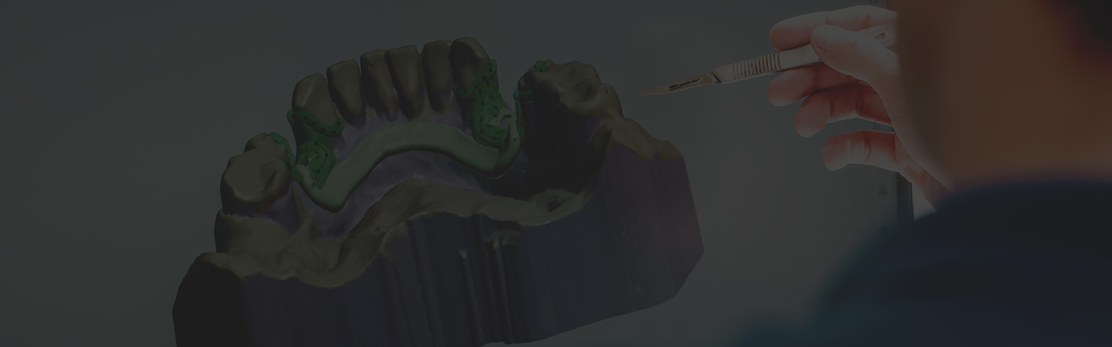 <h4 style="text-align: center;"> <strong> <span style="color: rgb(255, 255, 255);">디지털 임플란트</span> </strong> </h4> <br> <br>   <span style="color: rgb(108 147 155);">–––––––</span>  <br>   <h6 style="text-align: center;"> <span style="color: rgb(255, 255, 255);">디지털 임플란트란 무엇인가요?</span> <br> <br>  <span style="color: rgb(255, 255, 255);">디지털 임플란트는 CT와 구강스캐너로 <br>입안의 구조를 세밀하게 기록한 뒤, <br>컴퓨터 상에서 식립 위치와 방향을 미리 설계하는 방식입니다.</span>   </h6>