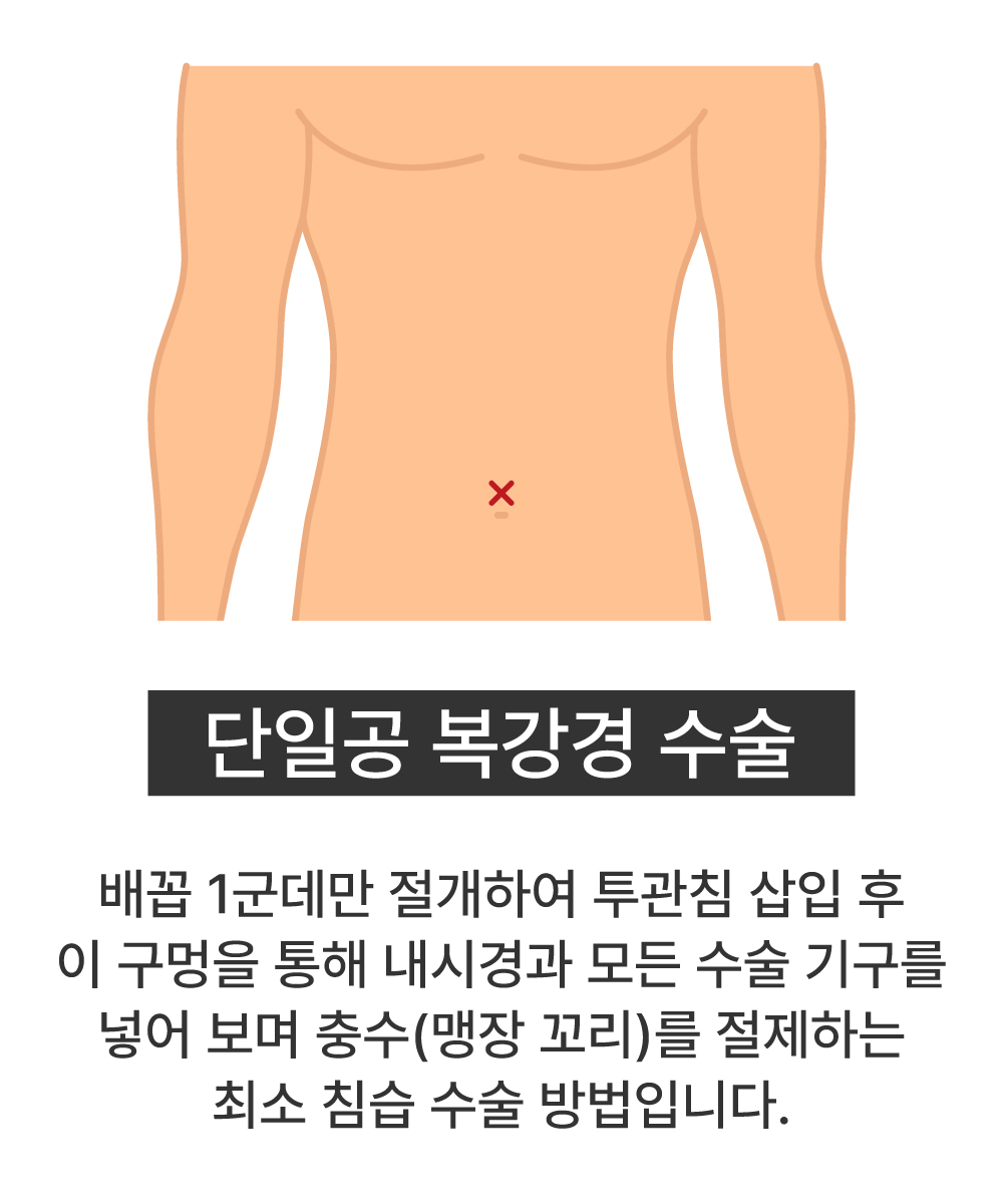 단일공 복강경 수술
