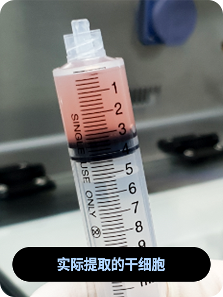 实际提取的干细胞