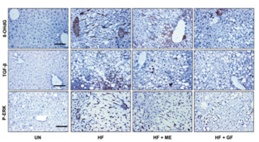 그림 1. 고지방식이 유도 간질환(NALFD) 동물모델