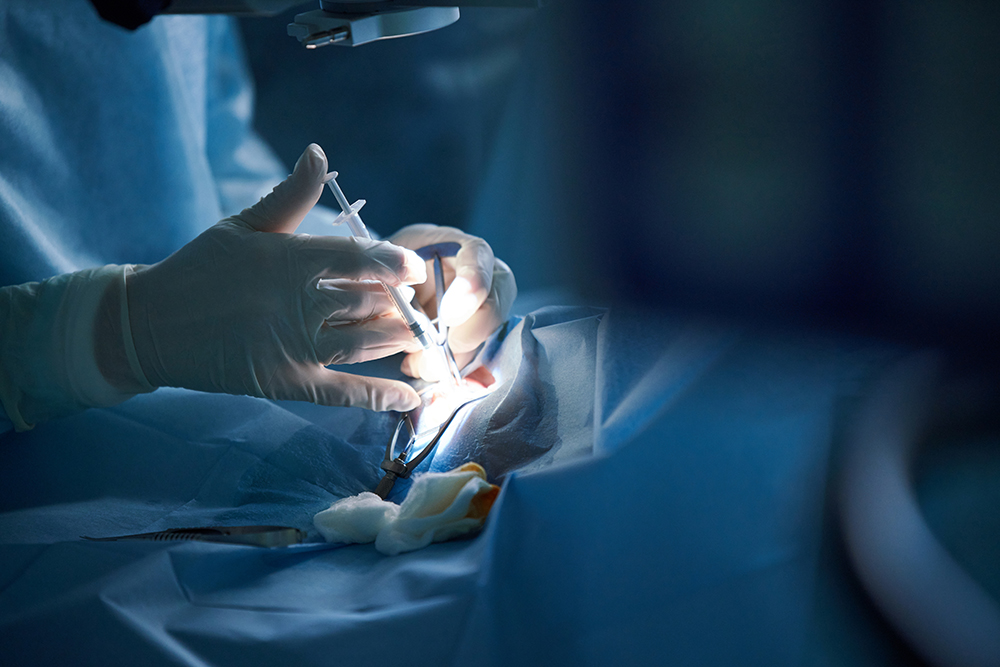 고주파 비염 수술