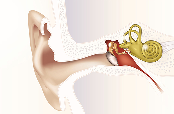 <B>와우막 파열</B>