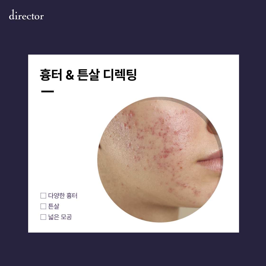 흉터디렉팅솔루션