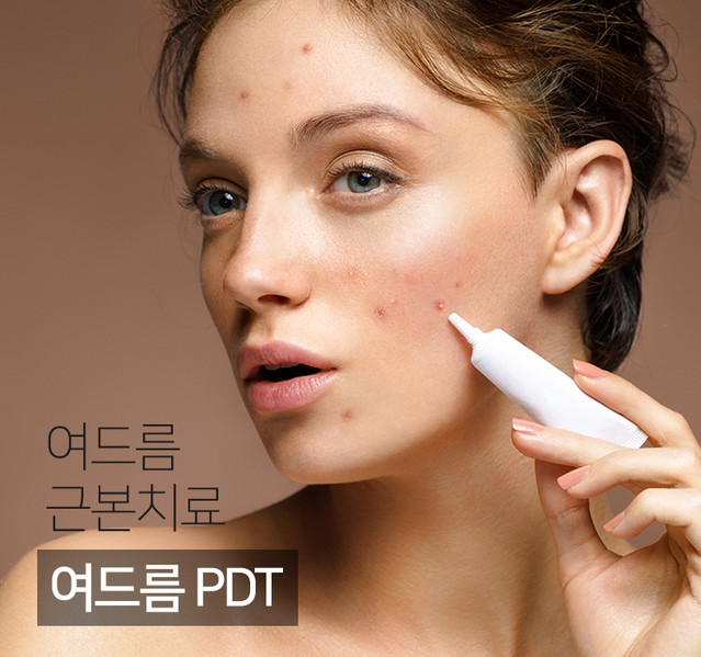 여드름PDT