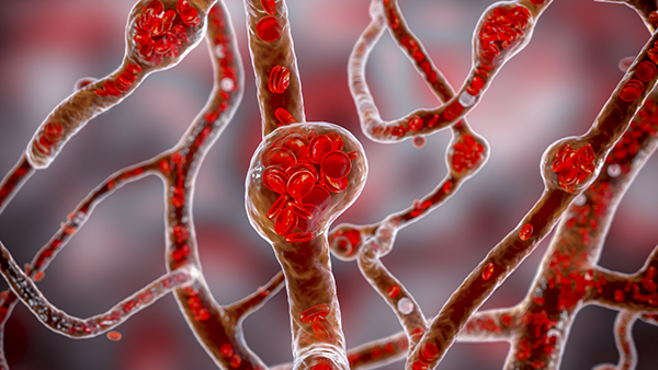 <B>내이 혈액순환 장애</B>