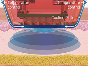 1. 첨단 쿨링 시스템