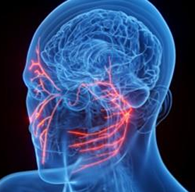 안면마비　 치료가이드