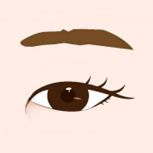 피부 재배치 앞트임