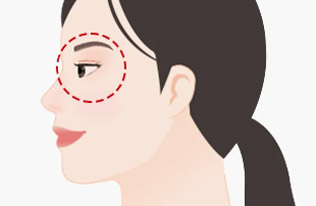 Windblown face effect, where the corners of the eyes and mouth appear stretched