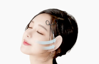 Pull the skin and remove excess skin