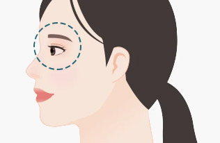 Natural beauty with SMAS and retaining ligament lifting