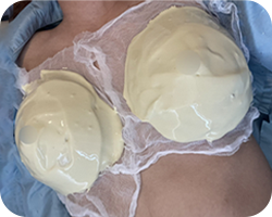 Aloe Breast Treatment