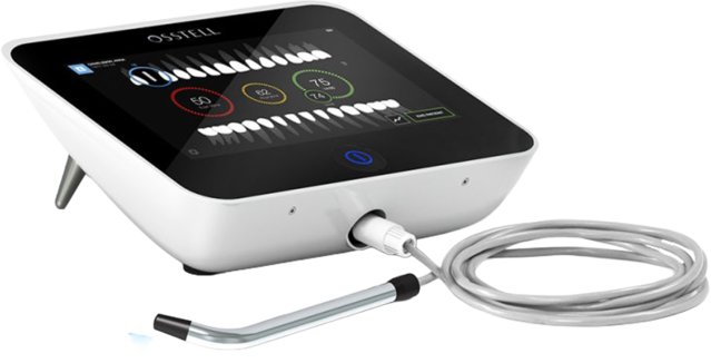 임플란트 동요도 측정기