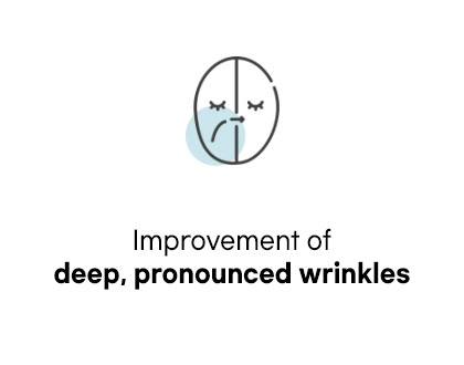 Improvement of deep, pronounced wrinkles