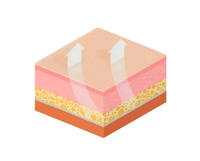 Лифтинг, подтягивающий до слоя SMAS