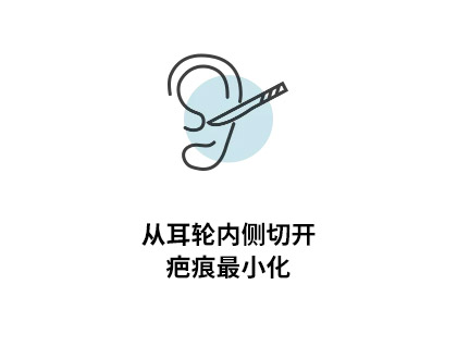 从耳轮内侧切开疤痕最小化