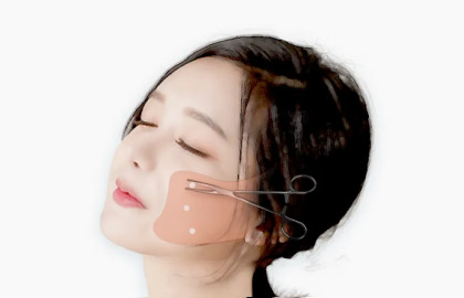 3 คลายสายพันธุ์ของเส้นเอ็นให้เหมาะสม