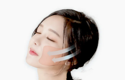 Рассечение кожи и слоя SMAS