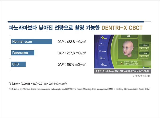 부산 연산동 키다리아저씨치과 CT2