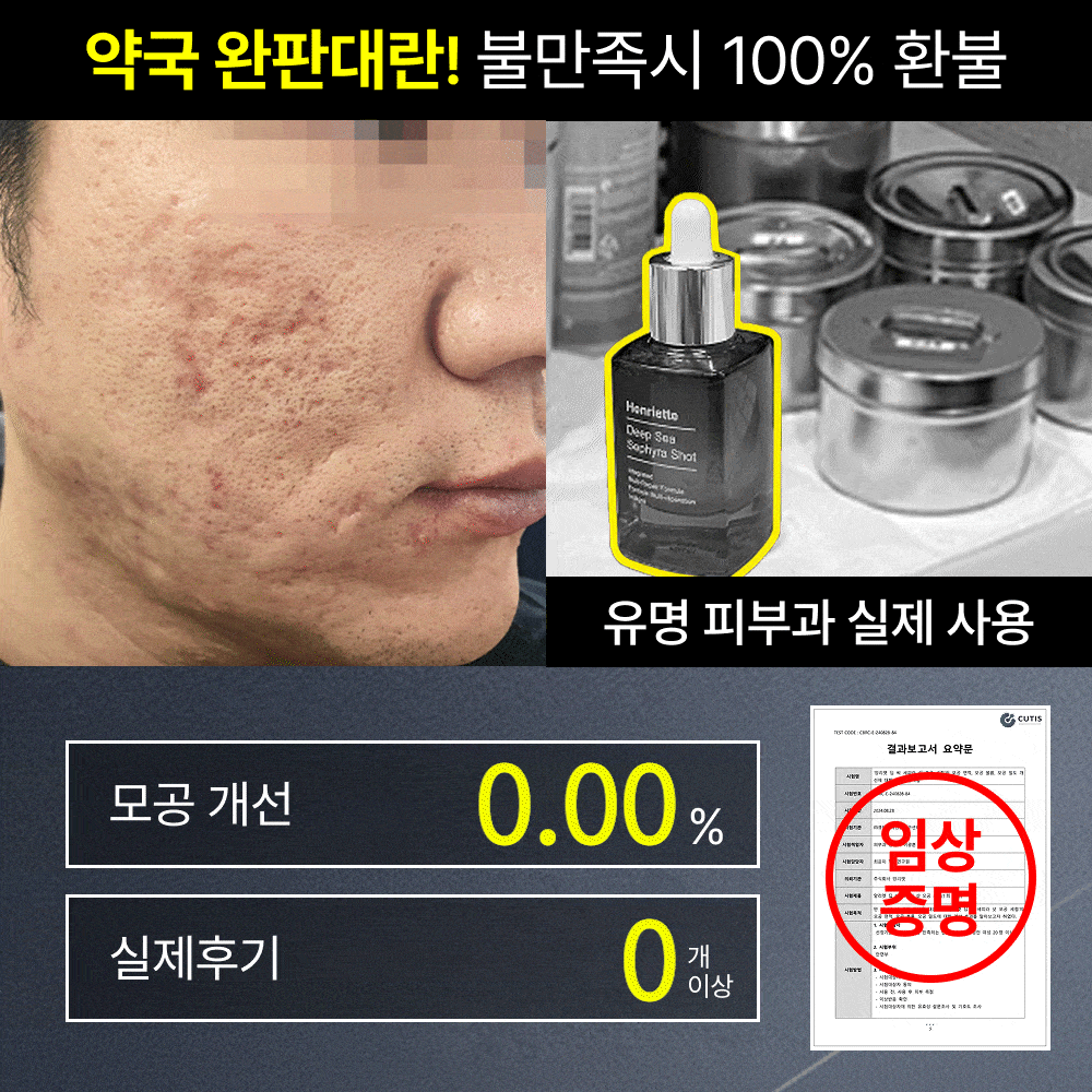 2시간 뒤 가격 상승💸 흉터성모공 개선 실험 성공! 피부과 모공슈링커 비밀특가