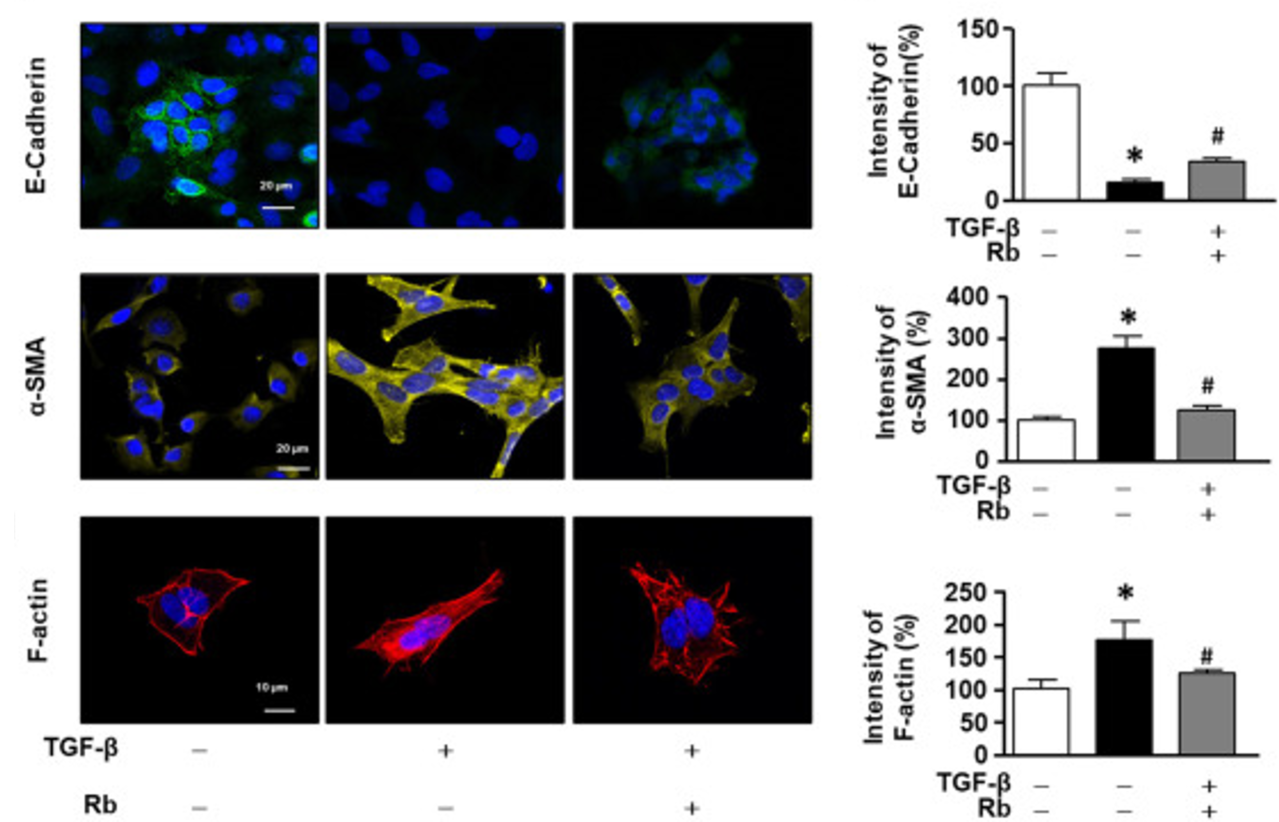 그림 1. TGF-β1 유도로 EMT가 유도된 세포에서 α-SMA 증가, E-cadherin 감소, F-actin 이 재구성된 패턴을 확인한 ICC 예시</br> Baek S, Kwon SH, Jeon JY, Lee GY, Ju HS, Yun HJ, Cho DJ, Lee KP, Nam MH. Radotinib attenuates TGFβ -mediated pulmonary fibrosis in vitro and in vivo: exploring the potential of drug repurposing. BMC Pharmacol Toxicol. 2022 Dec 15;23(1):93. doi: 10.1186/s40360-022-00634-x. PMID: 36522756; PMCID: PMC9753032.