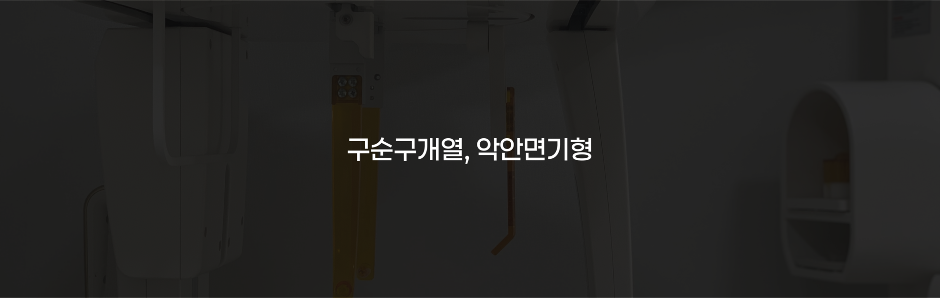 부산 연산동 키다리아저씨치과 구순구개열, 악안면기형