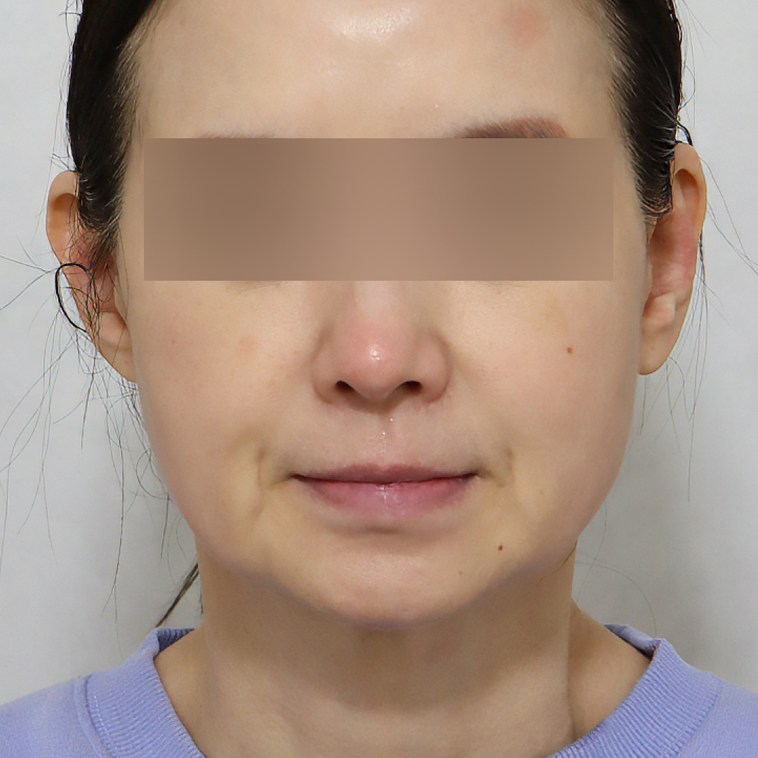 미니거상 before정면 이미지