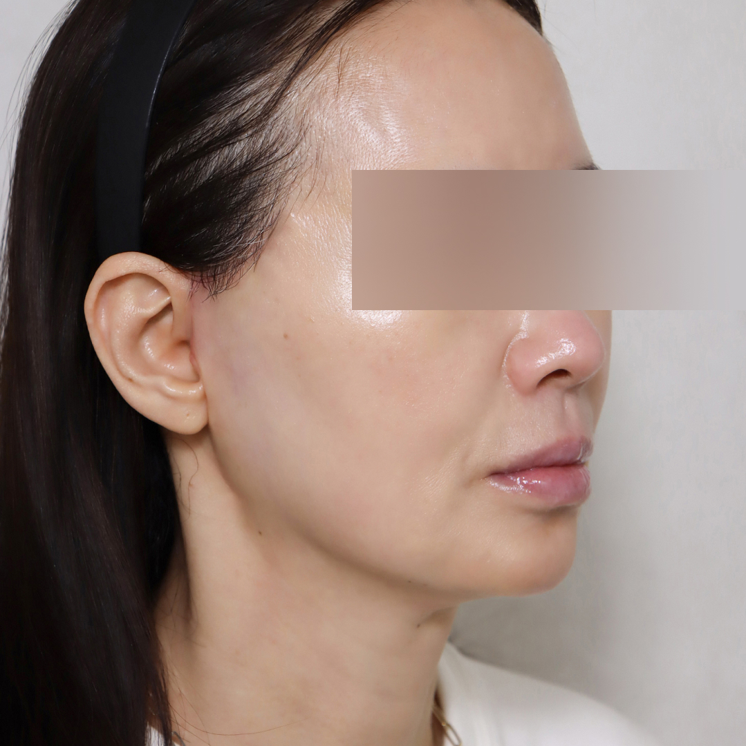 미니거상 after측면 이미지