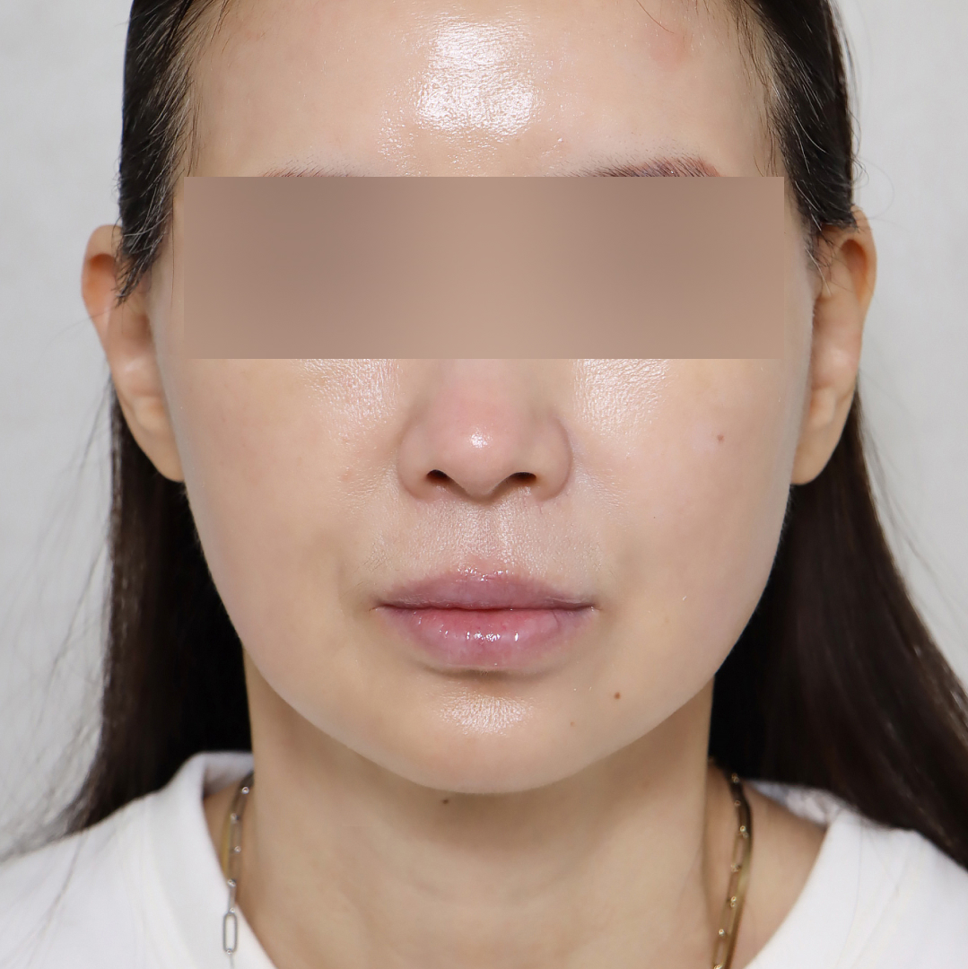 미니거상 after정면 이미지