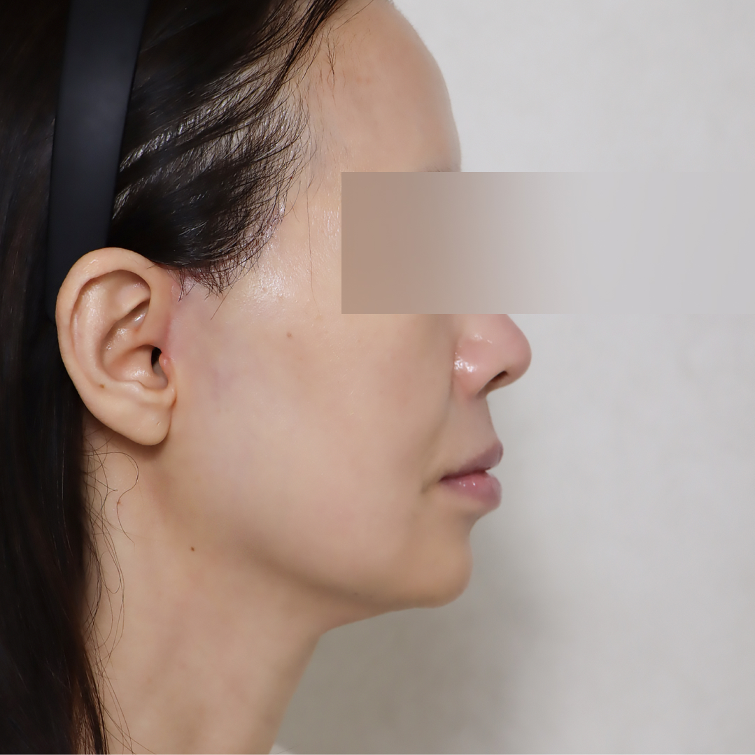 미니거상 after 90도 이미지