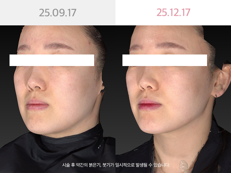 사진을  클릭해주세요↑