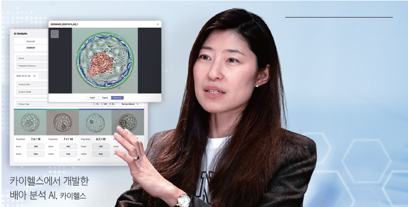 ©카이헬스 (AI 비전 기술로 난임 문제를 해결하는 회사)