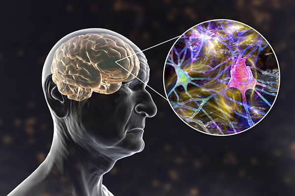 <B>청신경 종양 및 외상</B>