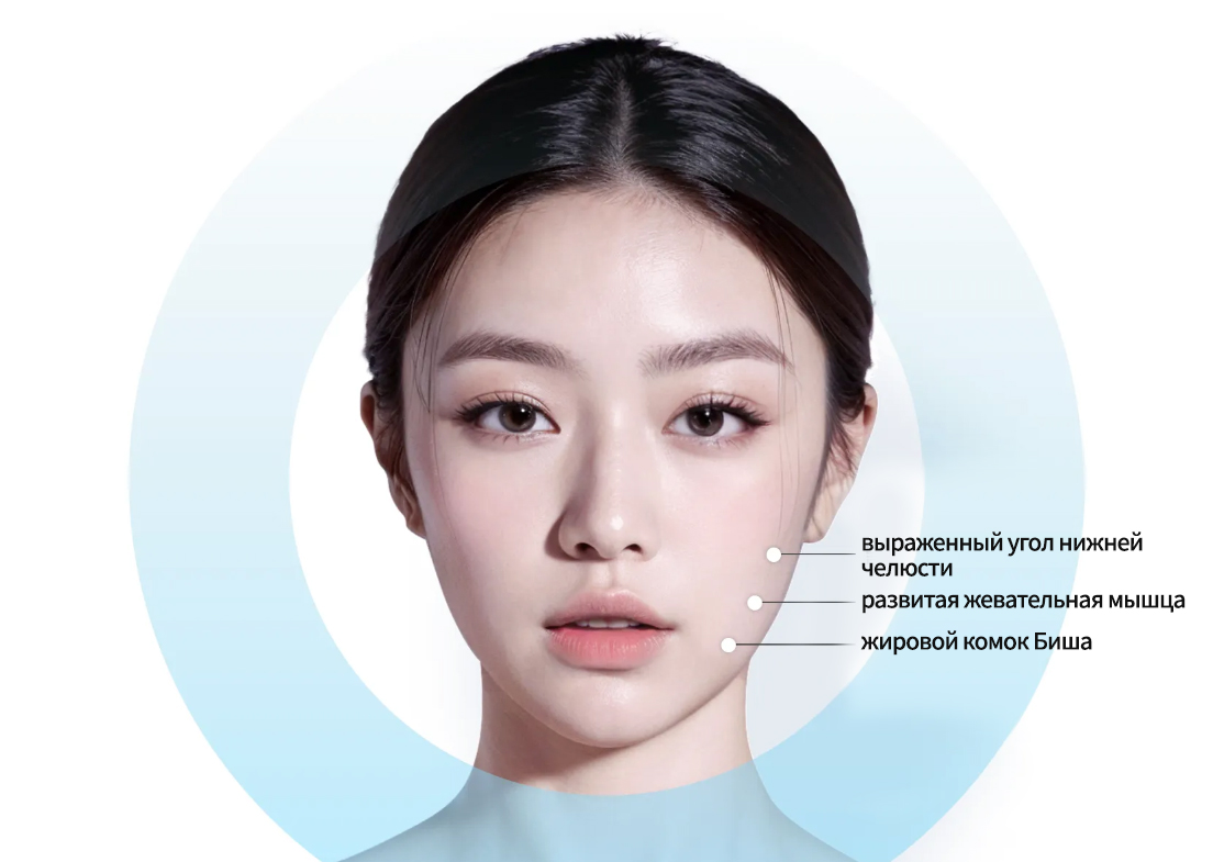 - выраженный угол нижней челюсти- развитая жевательная мышца- жировой комок Биша