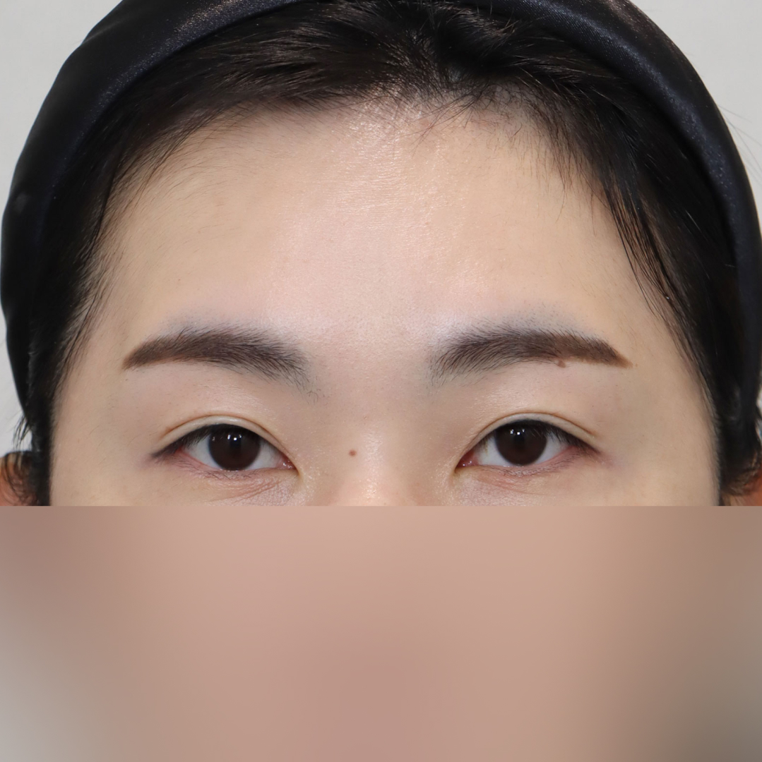 이마거상 After 정면