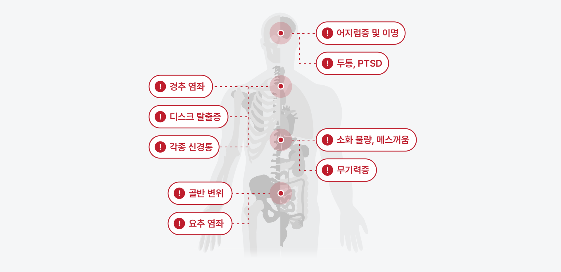 양산 교통사고 한의원