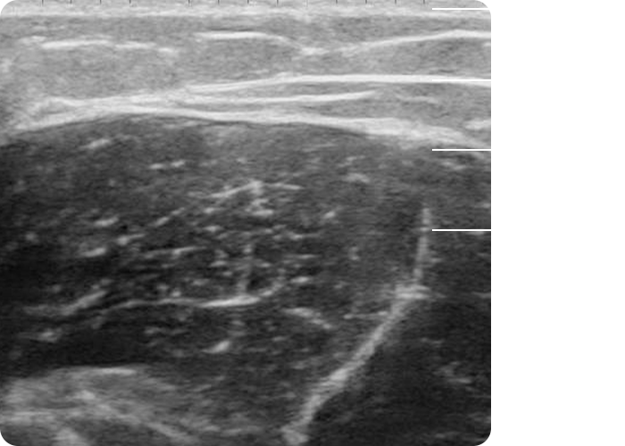 ultrasound examination