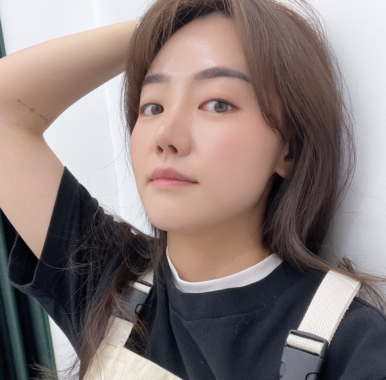 코재수술 콧볼축소 6개월 후