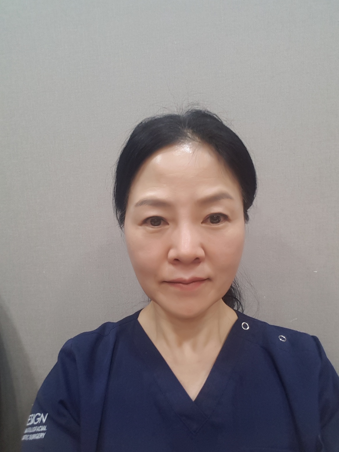 실리프팅 2주 후