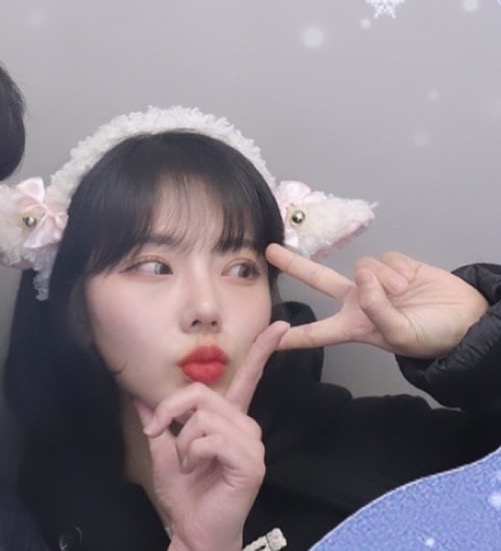 오른쪽 매몰 눈밑지방재배치 콧대 코끝 2개월 후