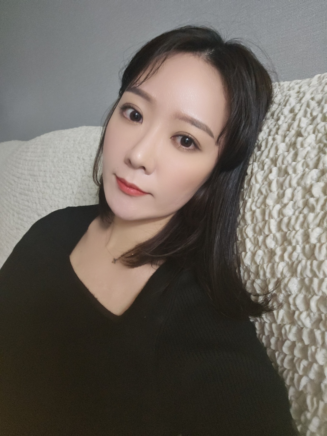 자연유착 지방제거 실리프팅 2개월 후