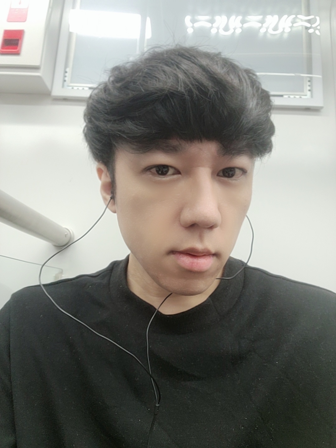 절개쌍꺼풀 눈매교정 눈밑지방재배치 2개월 후