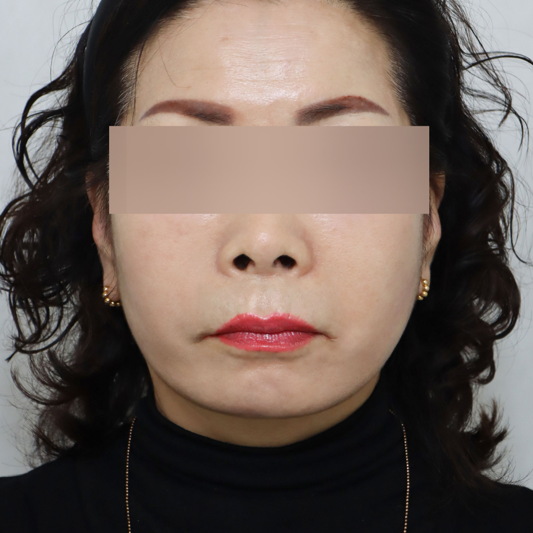 미니거상 after정면 이미지