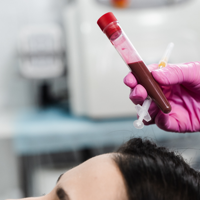 PRP compared with stem cell