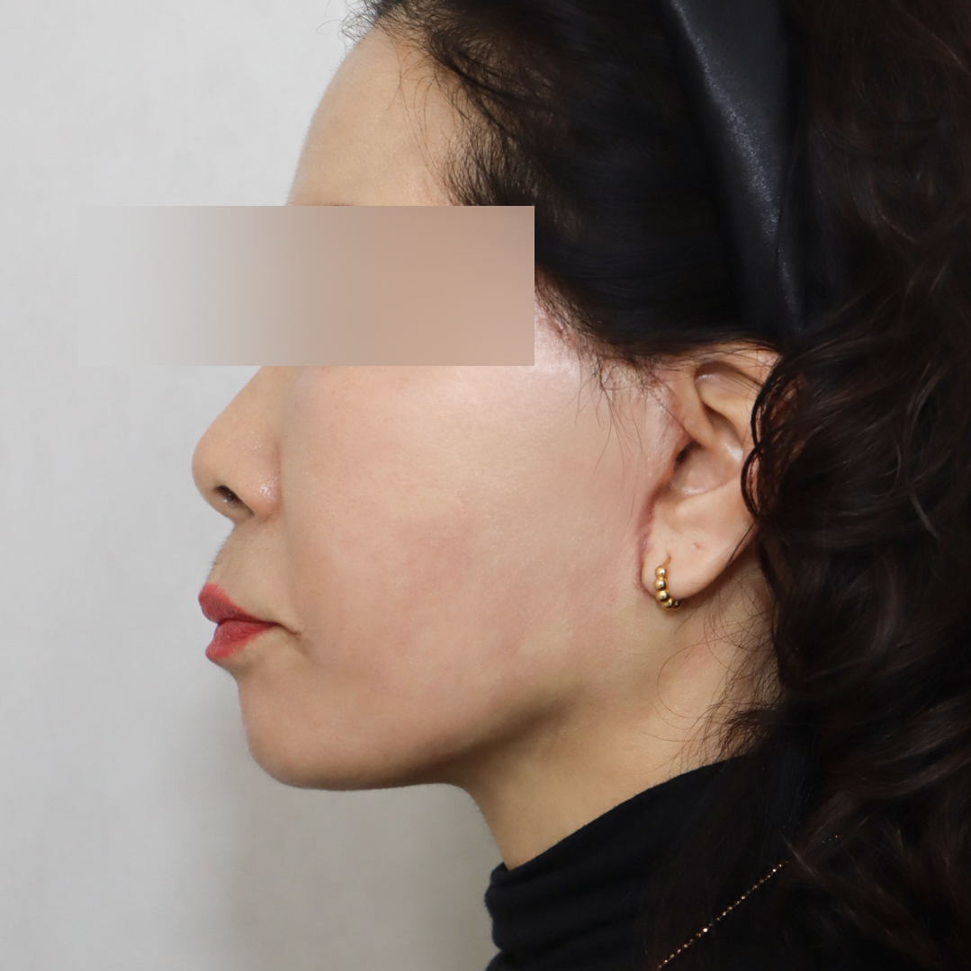 미니거상 after 90도 이미지